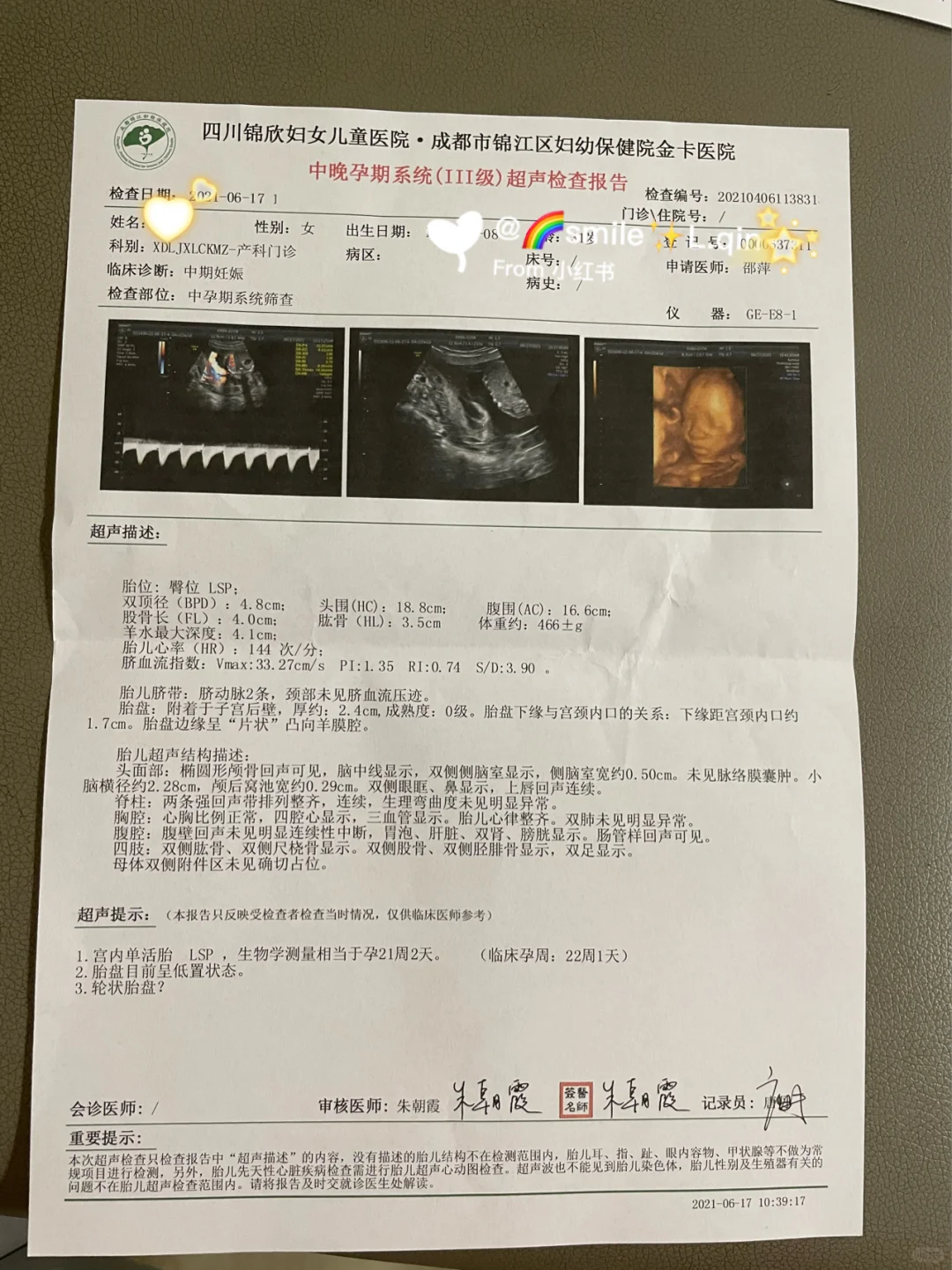 宝宝的四维影像揭晓：迎接新生命