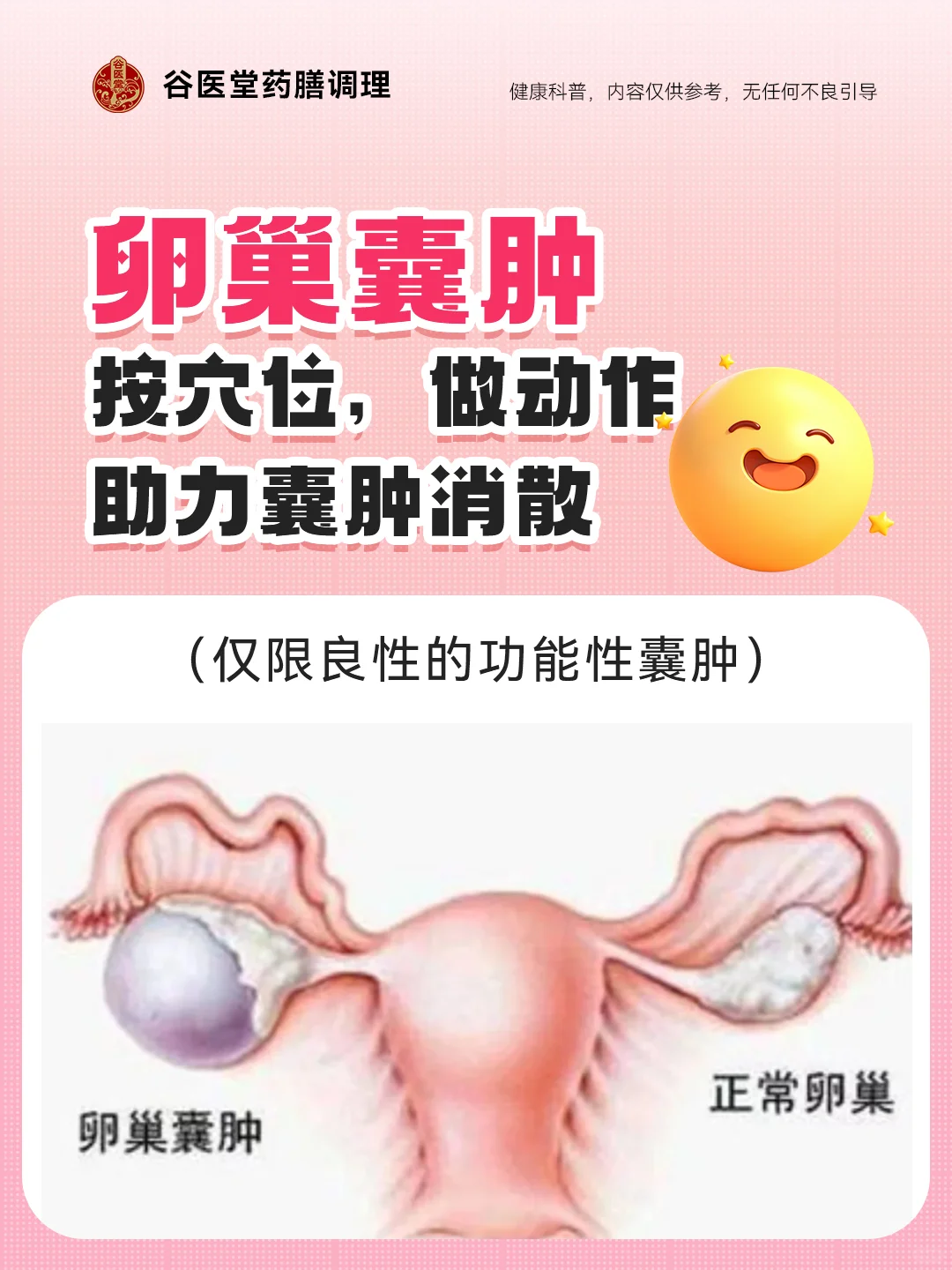 运动助卵巢囊肿消散，健康生活新选择