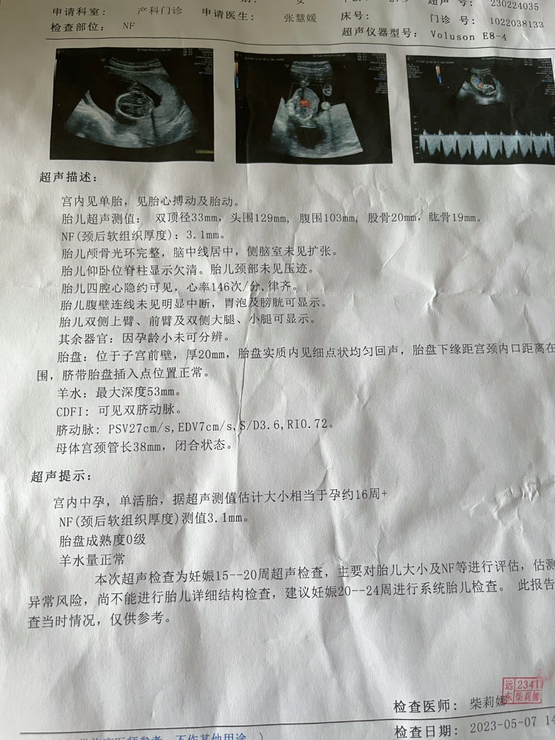 孕16W➕，NF过啦～,三代试管代孕聪明吗女性-锦欣生殖代孕