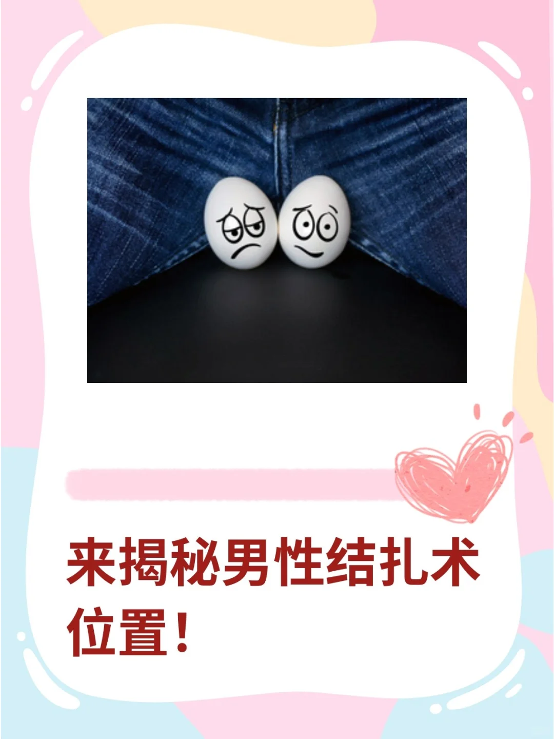 揭秘男性结扎手术：男性结扎术位置与咨询指南